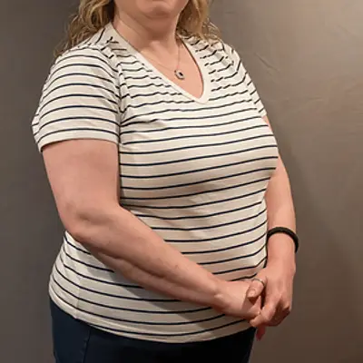 Dawn Wingerter - TMS psychiatrist in Leechburg Rd Lower Burrell