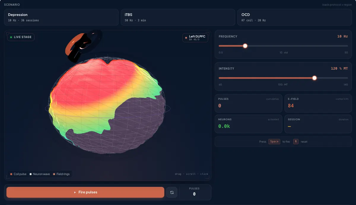 The TMS List simulator: a 3D brain with the coil over the left DLPFC and frequency and intensity controls